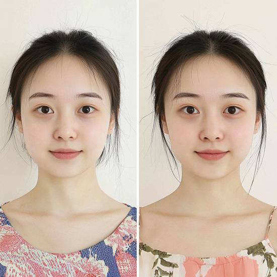 菱形脸怎么改变脸型，菱形脸重塑柔美脸型