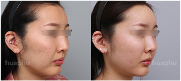 你也可以拥有童颜的自信 摩登时尚网 摩登时尚奢侈品顶尖媒体平台 摩登高端时尚网站